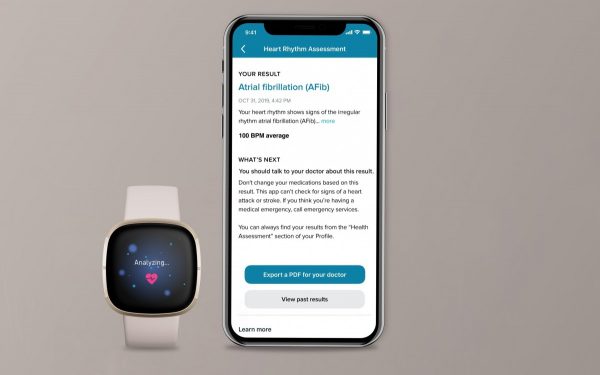 Fitbit Sense ECG