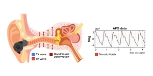 google-audiopletismografia auricolari anc in cardiofrequenzimetro